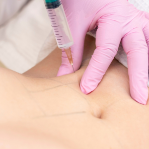 The New Weight Loss Phenomenon: Semaglutide Injections and the Need for Skin Tightening